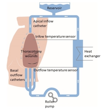 Systemic chart for 598 pleural mesothelioma patients